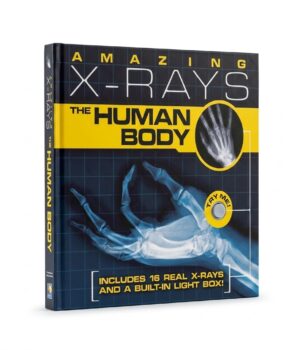 Amazing X-Rays: The Human Body